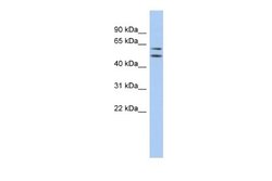 ABHD15 Rabbit anti-Human, Polyclonal, Novus Biologicals 0.1ml; Unconjugated:Antibodies,
